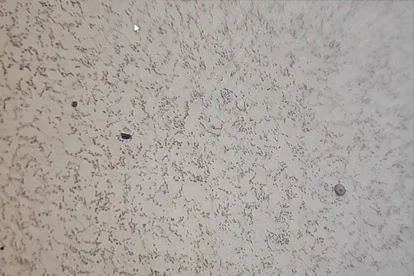 Metallografische inspectie – 500-voudige vergroting